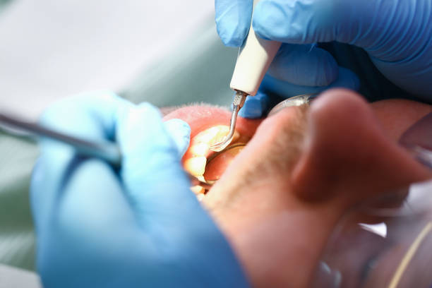 Best Mobile Emergency Dentist in East Point, GA