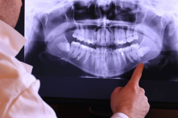 Best Emergency Dental Services for Seniors in East Point, GA