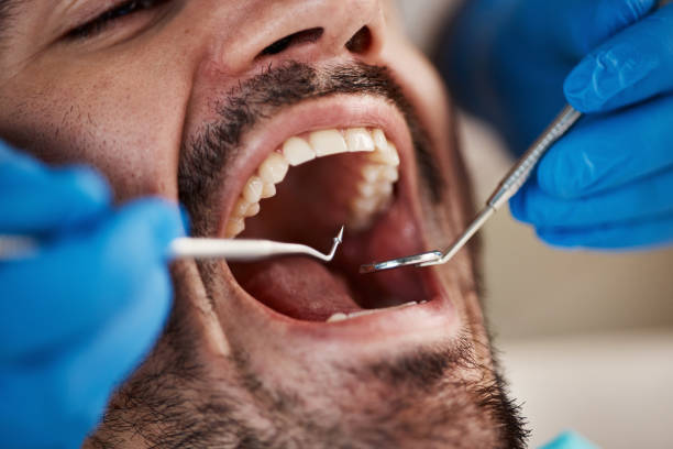 Best Emergency Dentist for Knocked-Out Tooth in East Point, GA