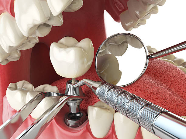 Best Emergency Cosmetic Dentistry in East Point, GA